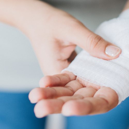 Angelegter Verband an einer verletzten Hand