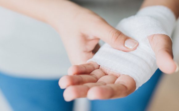 Angelegter Verband an einer verletzten Hand